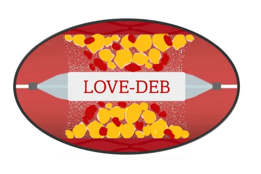 LOVE-DEB