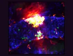 Image:  A Portrait of a Fiery Blood Clot, Credit: Sammy El-Mansi, Queen Mary University of London, British Heart Foundation - Reflections of Research