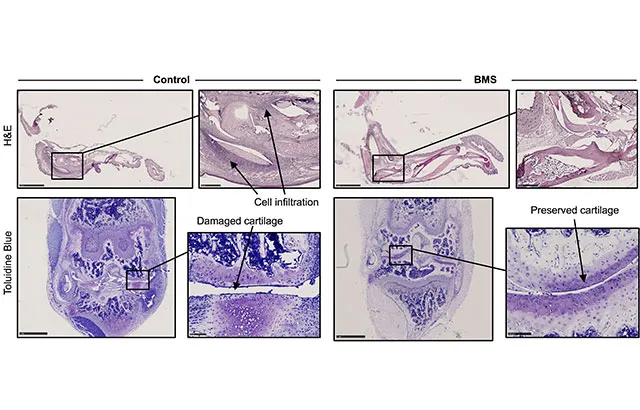 Arthritic were mice treated with either BMS or control saline