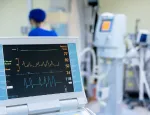 EKG monitor