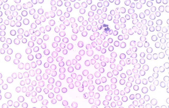 White blood cell packages