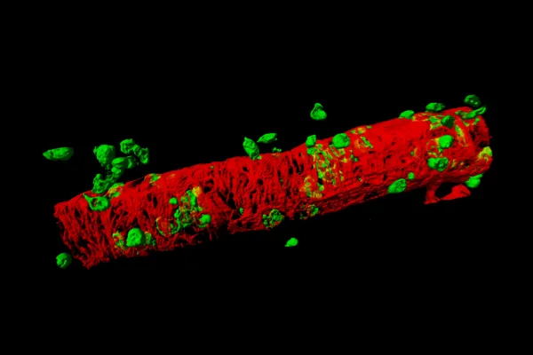 Centre for Microvascular Research