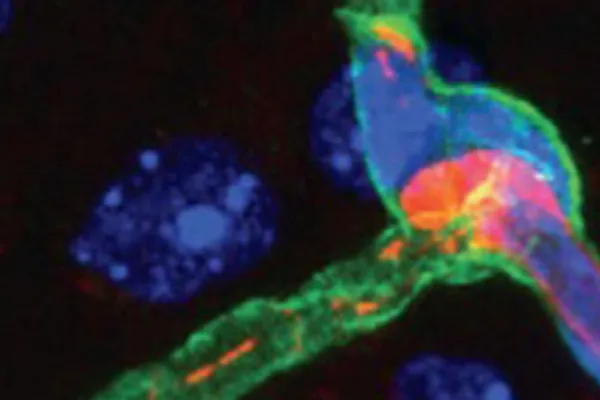 Centre for Translational Medicine and Therapeutics