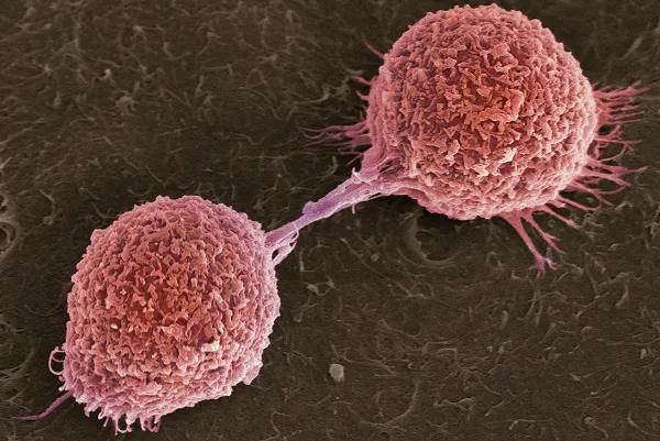 Barts Cancer Institute