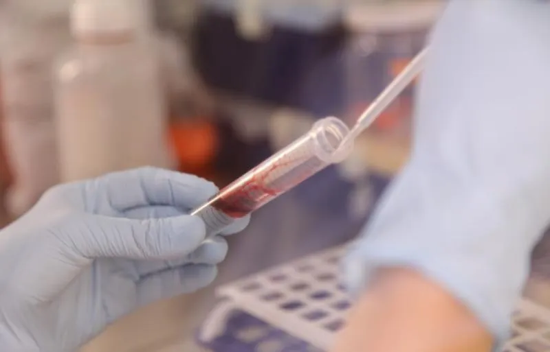 Blood sample