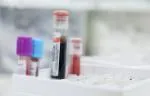 Vials containing blood. 