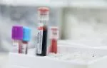 Vials containing blood. 