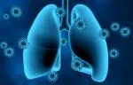 Coronavirus on lungs. Credit: feellife/iStock.com