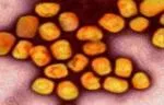 Colorized transmission electron micrograph of monkeypox virus particles (gold) cultivated and purified from cell culture. Image captured at the NIAID Integrated Research Facility (IRF) in Fort Detrick, Maryland. Credit: NIAID