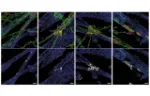 Representative 3D reconstruction images of human neuromuscular junctions