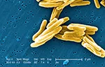 tuberculosis secondary