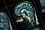A scan of a human brain