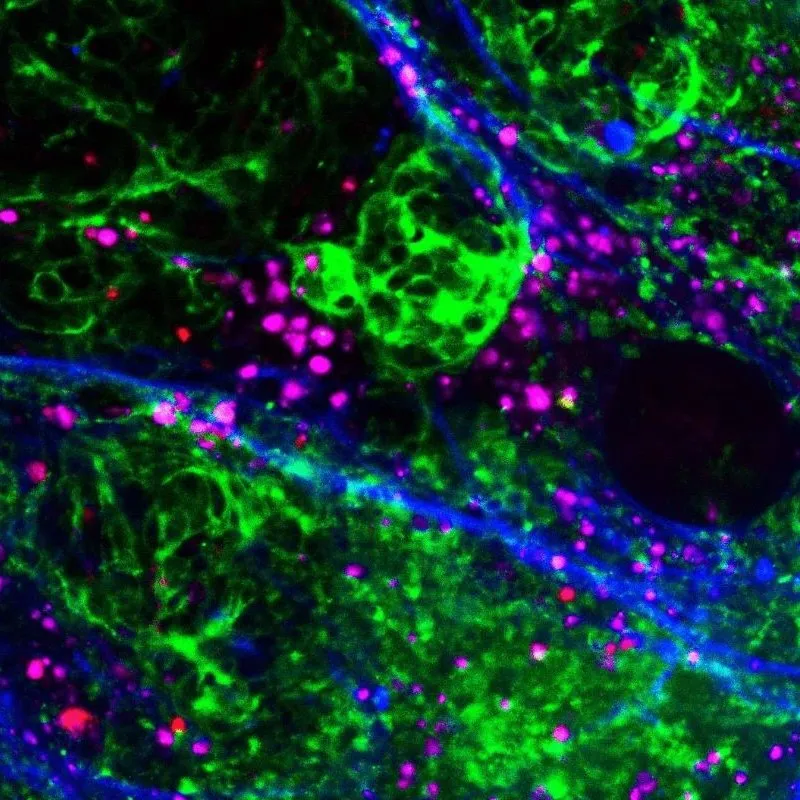 Image of cells showing cancer cell in colour