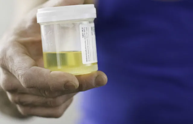 Cervical cancer testing