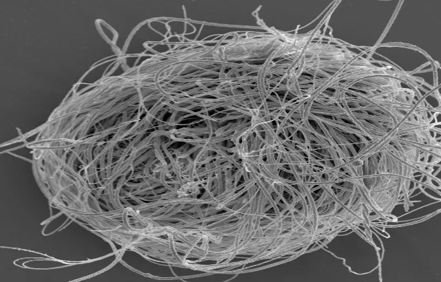 A bundle of giant sperm of the present-day ostracod crustacean Cyclocypris serena. Photo credit: R. Matzke-Karasz.