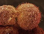 Pancreatic cancer cells CC BY-NC Credit Anne Weston, Francis Crick Institute