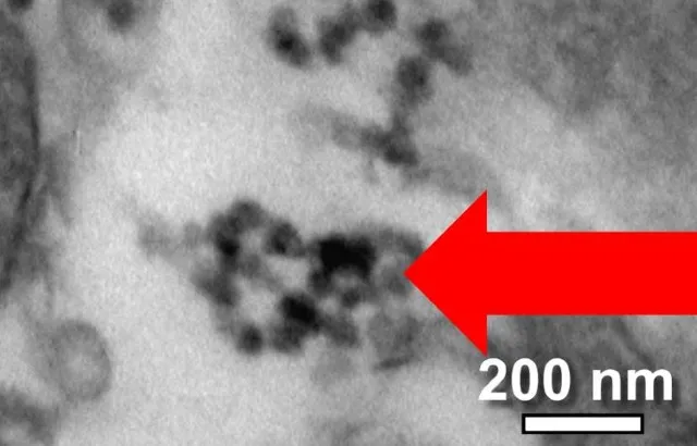 Black inclusions in placental cells resembling inhaled particulate matter