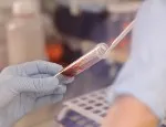 Blood sample