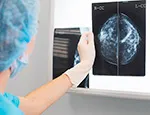 Breast screening
