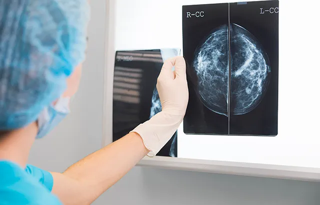 Breast screening