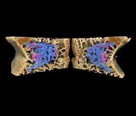 The Bionic Bone