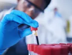 Man doing analysis on blood collection tubes in the laboratory