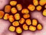 Colourised transmission electron micrograph of monkeypox virus particles (gold) cultivated and purified from cell culture. Image captured at the NIAID Integrated Research Facility (IRF) in Fort Detrick, Maryland. Credit: NIAID