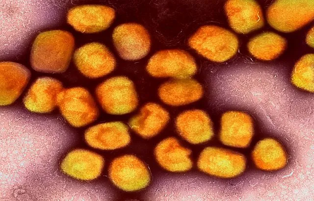 Colourised transmission electron micrograph of monkeypox virus particles (gold) cultivated and purified from cell culture. Image captured at the NIAID Integrated Research Facility (IRF) in Fort Detrick, Maryland. Credit: NIAID