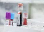 Vials containing blood. Credit: Centre for Trauma Sciences.