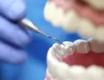 Close-up view of dentist hands at work