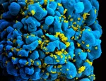 Image of HIV infected T cells under a microscope