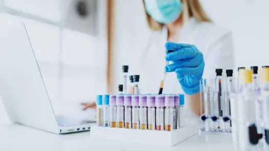 Queen Mary University spinout Procyon Diagnostics to provide early cancer tests 