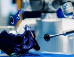 The robotic arm working in the hospital