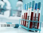 Blood samples and test results in a clinical medical laboratory.