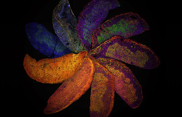 'The Placenta Rainbow' by Dr Suchita Nadkarni