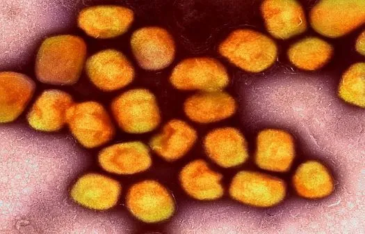 Ending Africa&rsquo;s mpox outbreak  
