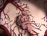 CREDIT: Barts Cancer Institute, QMUL