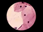 A cytologic smear under the microscope