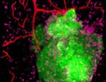Mouse model of ovarian cancer showing cancer cells in green, immune cells in pink and blood vessels in red