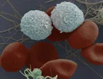 Image credit - London Research Institute's Electron Microscopy Unit