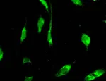 PXR in isolated human blood vessel cells