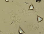 Droplets with tail-like filaments. Credit: Emily Lin.