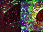 Wound healing in fetal membranes. Images show collagen (left) and cells (right).