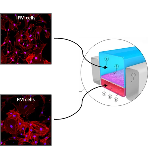 IFM cells