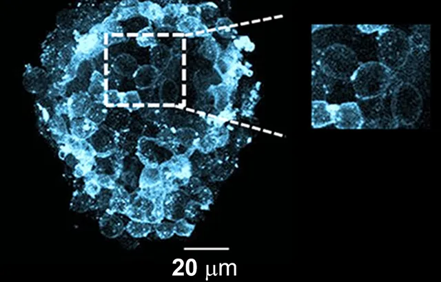 The photo shows one of the probes in cellular membranes of pancreatic cells