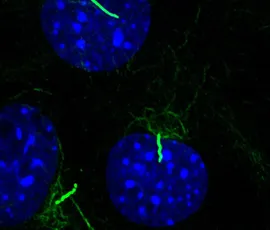Primary cilia 