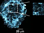 The photo shows one of the probes in cellular membranes of pancreatic cells