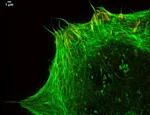 Focal adhesions and actin