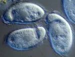 The single-celled Plagiopyla © B.J. Finlay