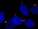 This confocal microscopy image shows cilia (in red) are the thin hair-like structures only a few 100th of a millimetre long.